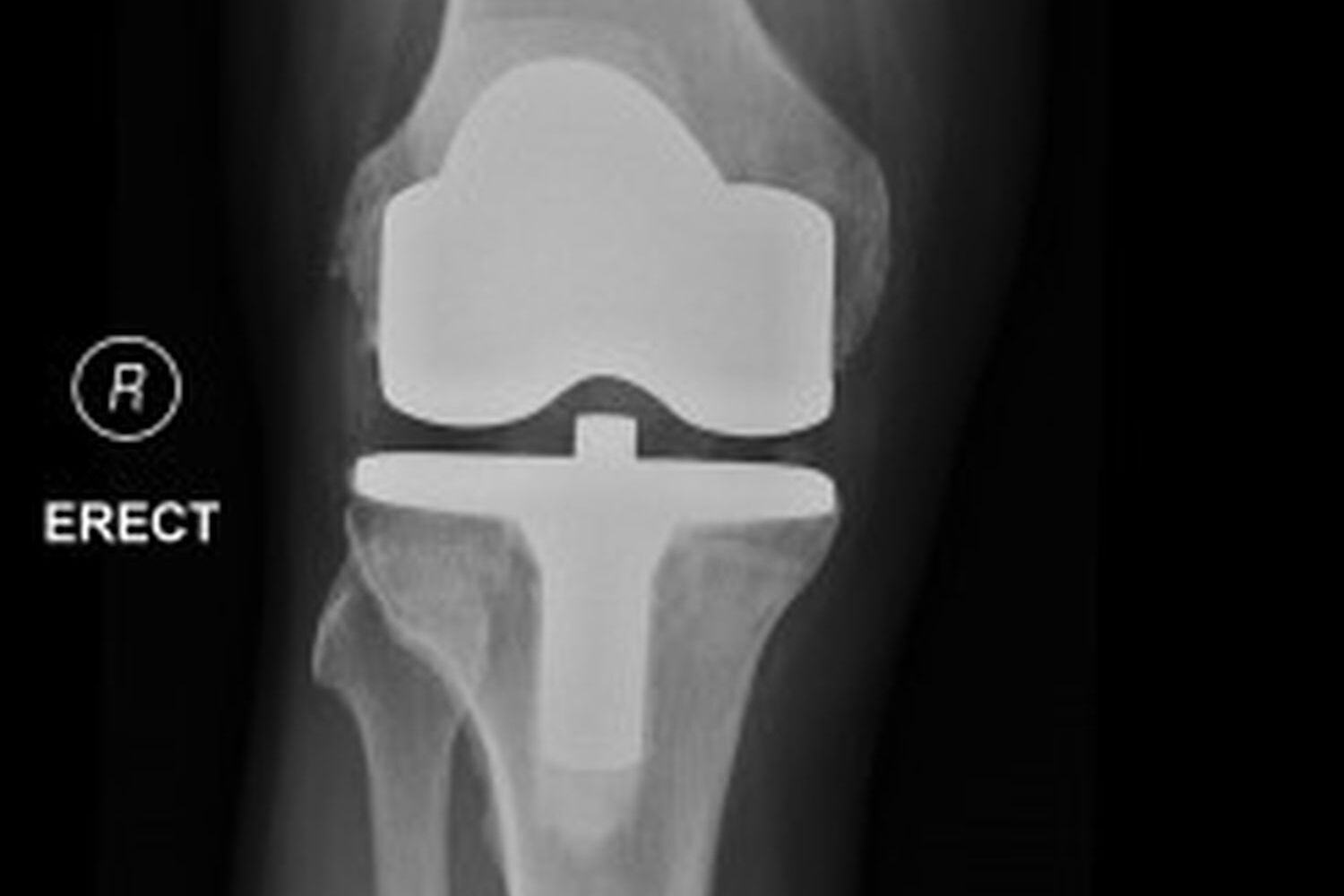 Bh Xray2 27Aef0D2F4171C8B0Fe5D926Ed95Ebdb