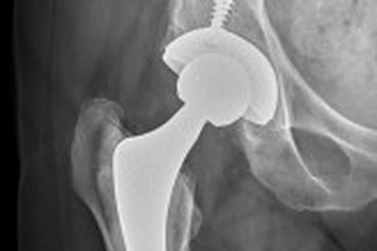 Bh Xray1 27Aef0D2F4171C8B0Fe5D926Ed95Ebdb